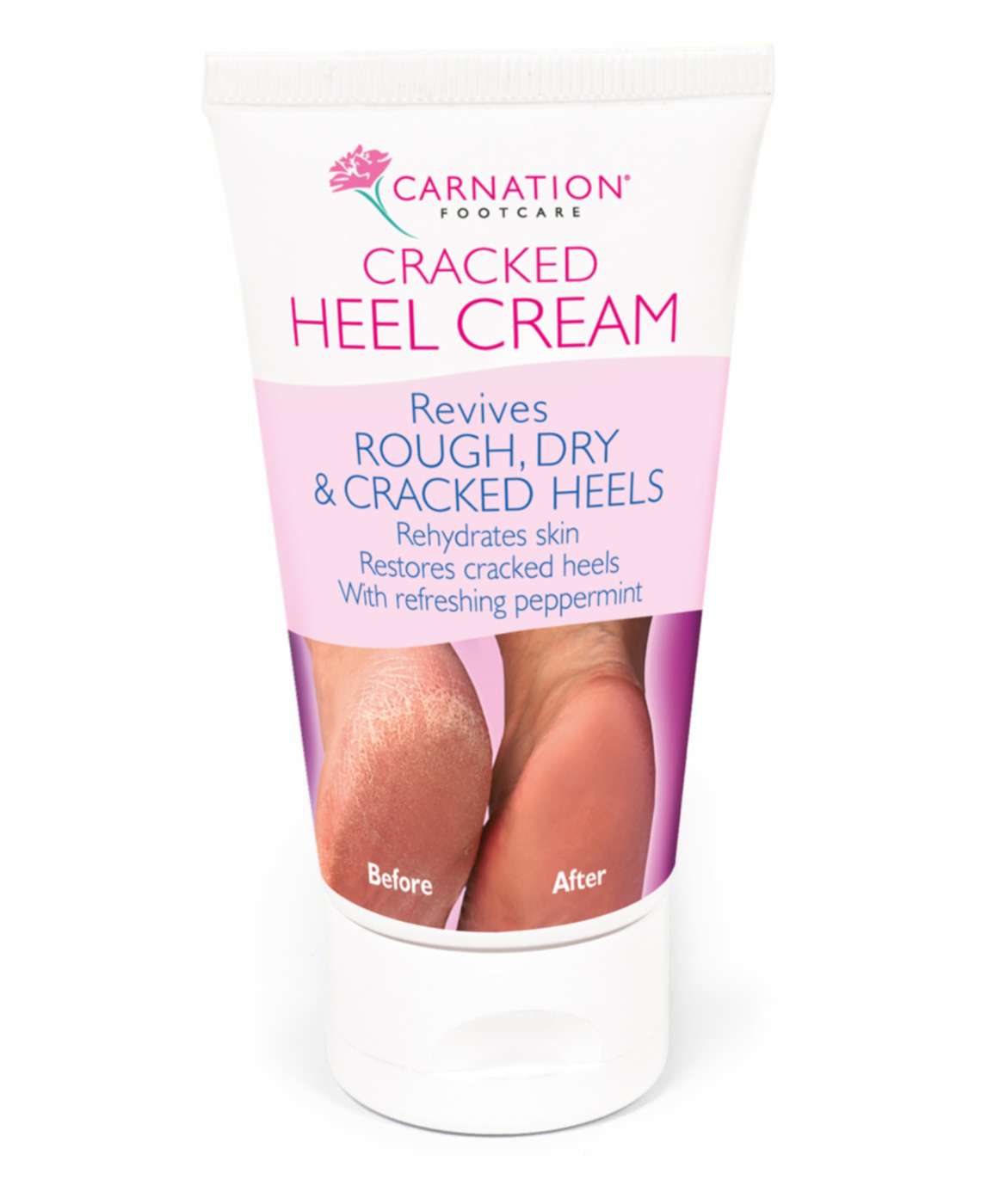 dry heel cream
